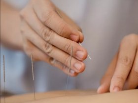 Acupuncture for Fertility - GinSen