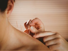Acupuncture for PCOS - TCM Blog