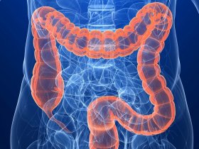 Colon Cancer Treatment in Ahmedabad