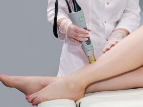 Common Myths About Laser Removal