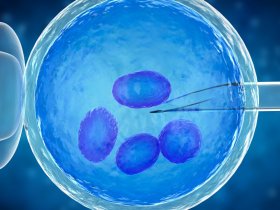 Is IVF (In Vitro Fertilization) Painful?