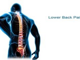Lower Back Pain Remedies