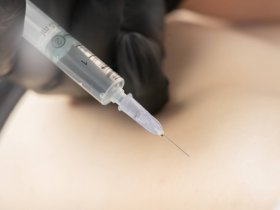 Platelet Rich Plasma Therapy