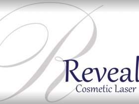 Reveal Costmetic Laser