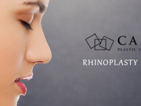 Rhinoplasty Melbourne