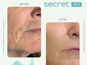Skin Texture Treatment