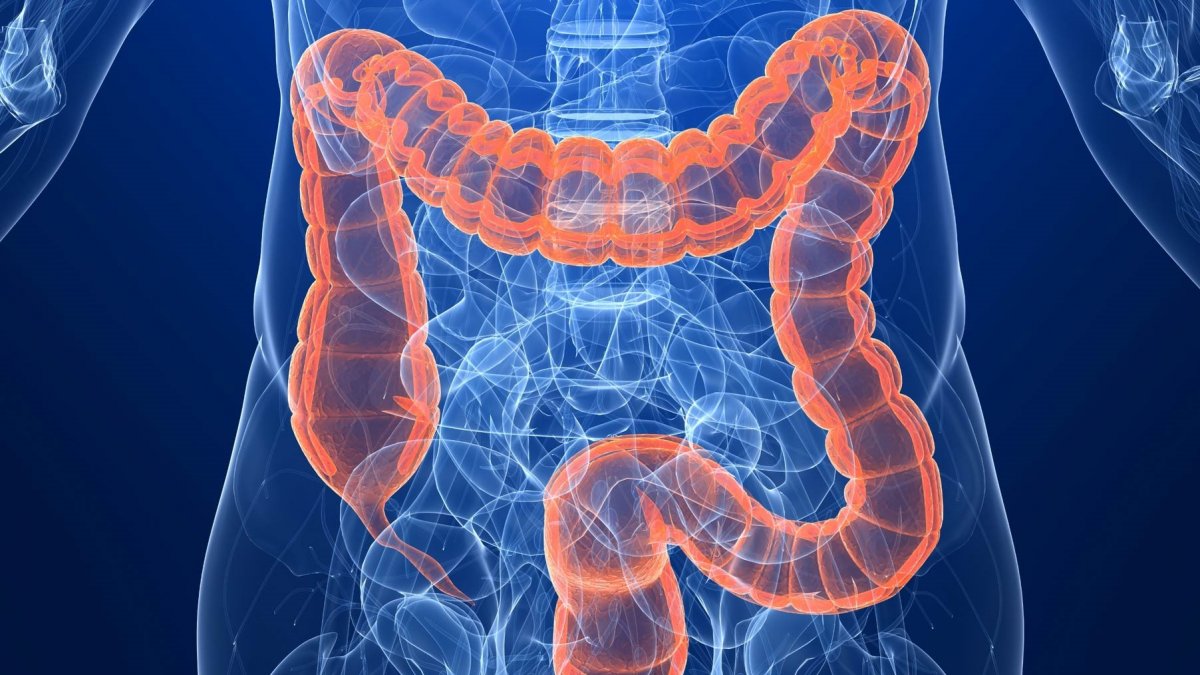 colon-cancer-treatment-in-ahmedabad